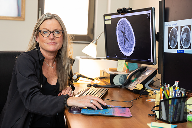 Person at a desk viewing brain scans on dual monitors, with office supplies visible. Transcribed text on monitor: "What is a Stroke?" 